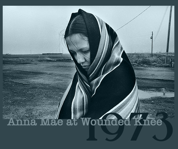 This image has an empty alt attribute; its file name is annawoundedknee2.jpg